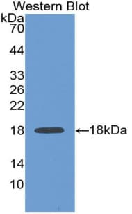 ANXA4 / Annexin IV Antibody (aa3-151)