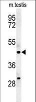 STAMBPL1 Antibody (aa135-163)