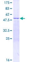 Human GS28 / GOSR1 / p28 Protein (Recombinant GST)
