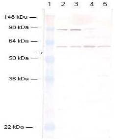 IHC-plus™ Polyclonal Rabbit anti-Human AKT1 + AKT2 Antibody (IHC, WB)