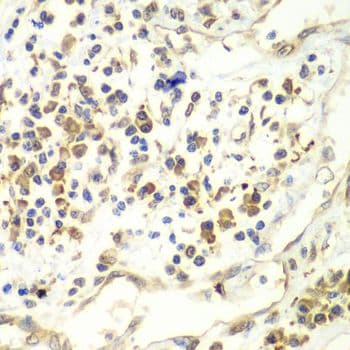 RENT1 / UPF1 Antibody