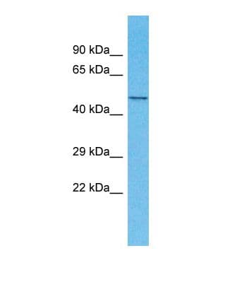 Polyclonal Rabbit anti-Human TMEM194A Antibody (aa34-83, WB)