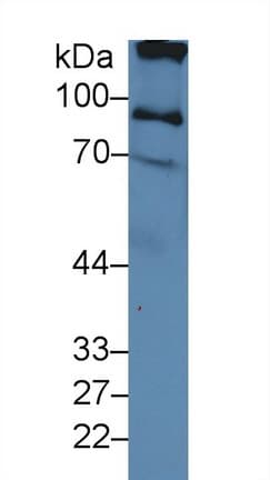 ITIH2 Antibody (aa452-702)