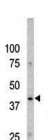 CASP9 / Caspase 9 Antibody (phospho-Ser196)