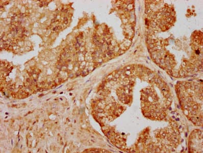 Polyclonal Rabbit anti-Human C14orf177 Antibody (IHC)