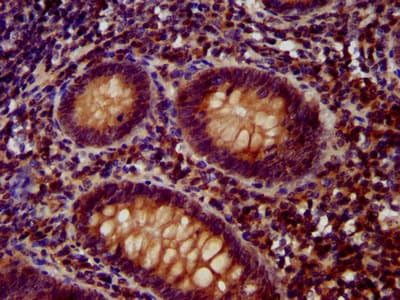 OTUD7B / Cezanne Antibody