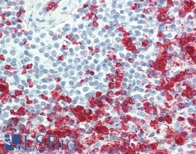 IHC-plus™ CCL17 / TARC Antibody