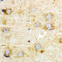 Polyclonal Rabbit anti-Human GFAP Antibody (N-Terminus, IHC, IF, WB)
