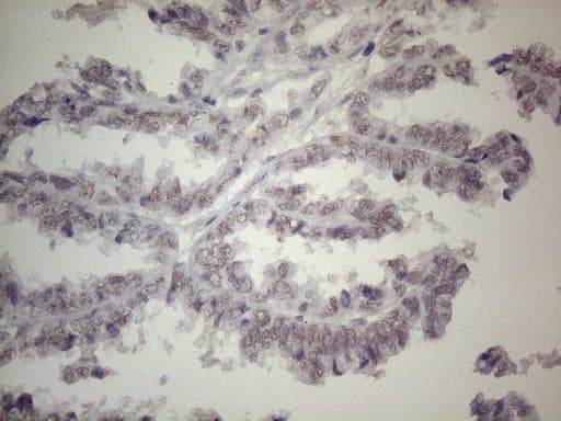 TLK2 Antibody (aa1-296, clone OTI3E10)