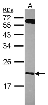 Polyclonal Rabbit anti-Human RGS10 Antibody (aa1-173, IHC, WB)