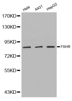 FSH Receptor / FSHR Antibody