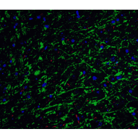 CLU / Clusterin Antibody