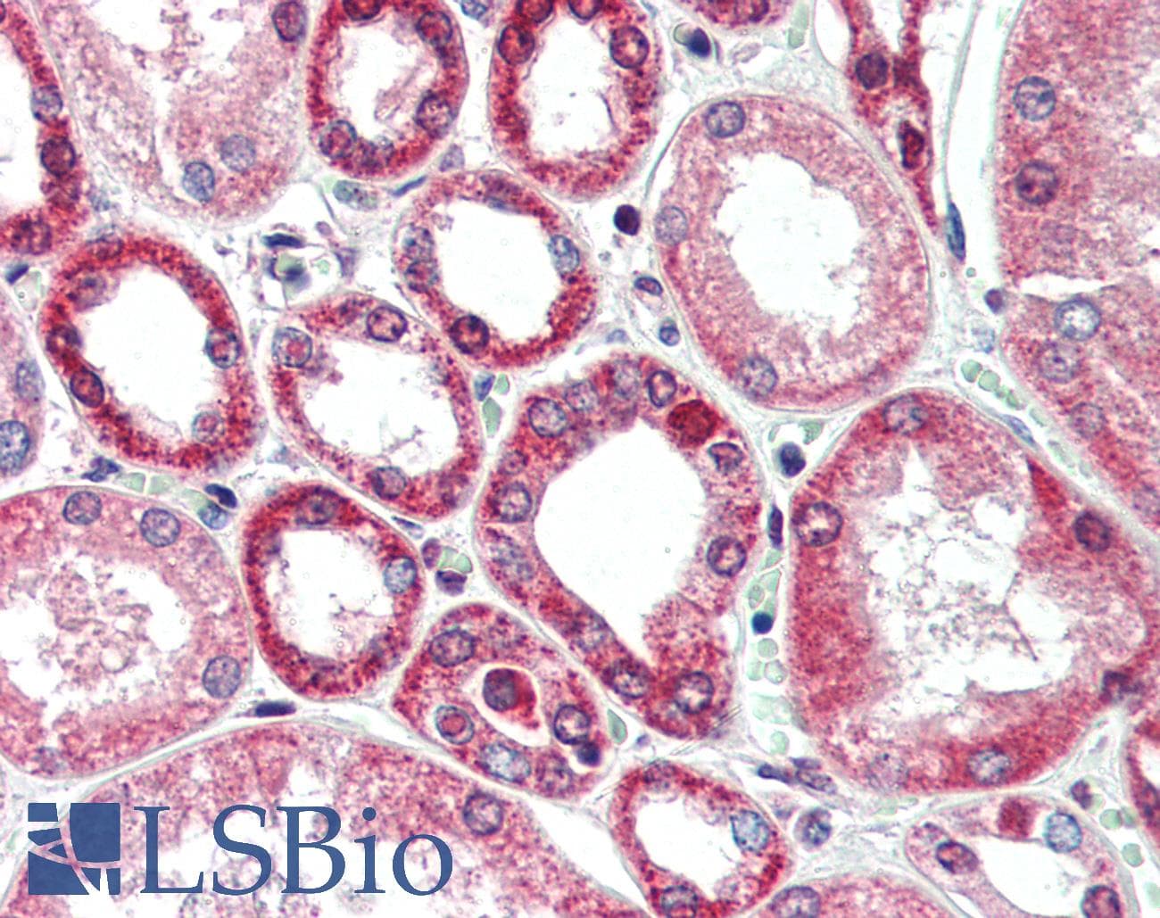 Polyclonal Rabbit anti-Human BECN1 / Beclin-1 Antibody (IHC, IF, WB)