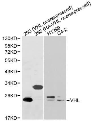 Polyclonal Rabbit anti-Human VHL / Von Hippel Lindau Antibody (IHC, WB)