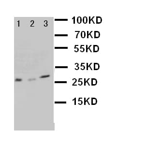 KLK1 / Kallikrein 1 Antibody (aa182-197)