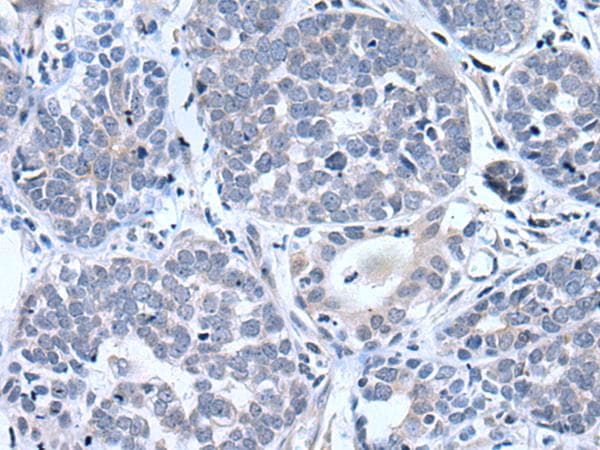 BTG4 Antibody