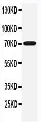 SLC6A4 / SERT Antibody (aa7-24)