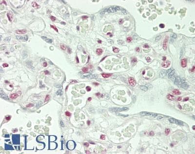 IHC-plus™ DDX5 Antibody (aa575-C-term)