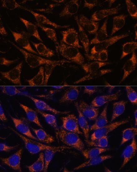 ACAA2 Antibody