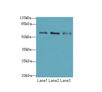 GPCR6 / GPR101 Antibody