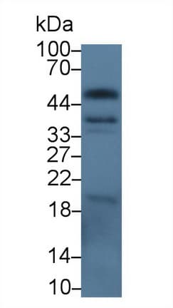 EPCAM Antibody (aa21-260, APC)