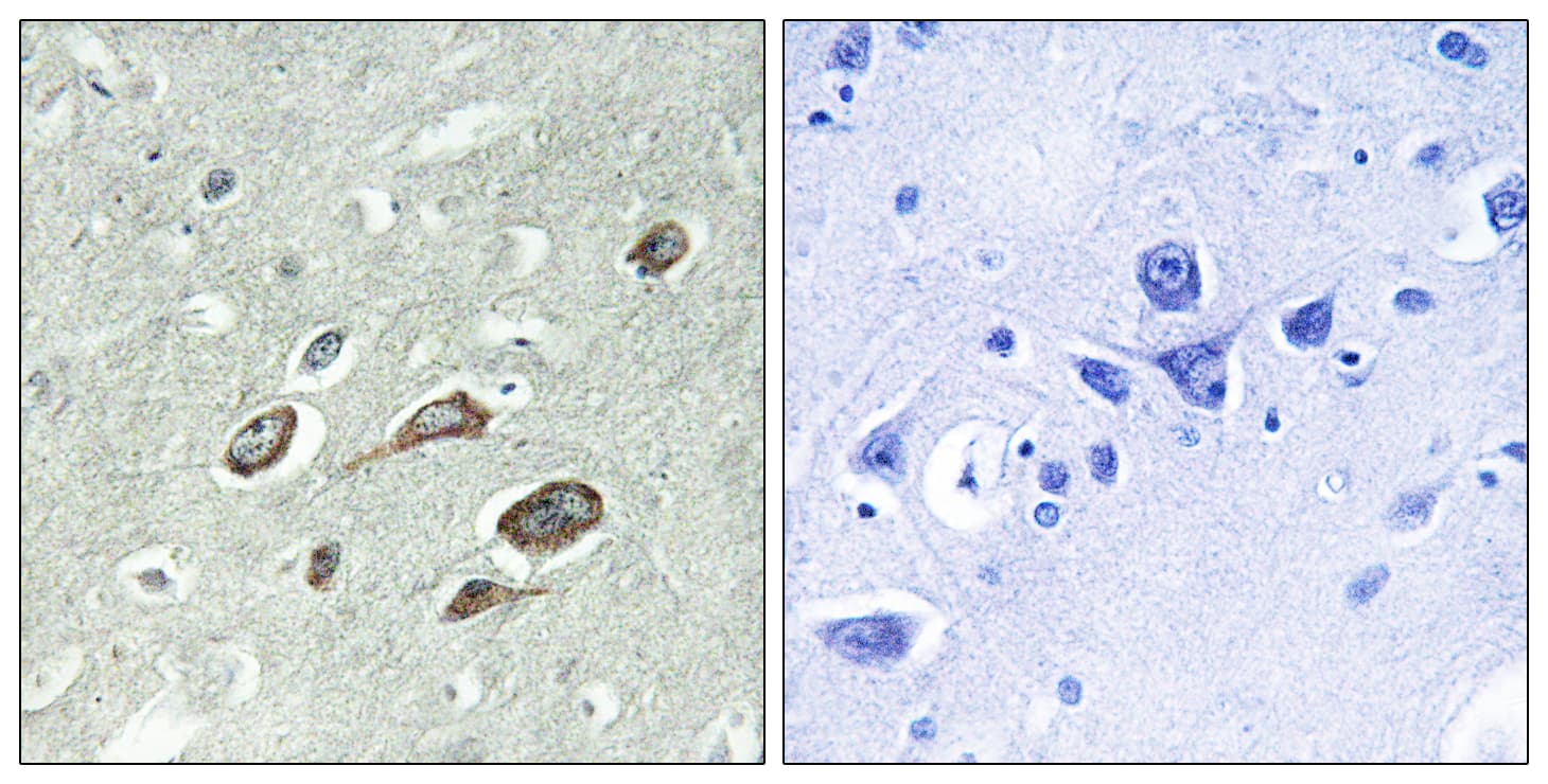 Calmodulin Antibody (phospho-Thr79)