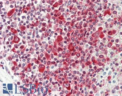 IHC-plus™ Polyclonal Rabbit anti-Human RPS6 / Ribosomal Protein S6 Antibody (aa200-C-term, IHC, IF)