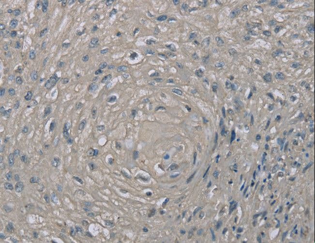 Polyclonal Rabbit anti-Human EDN1 / Endothelin 1 Antibody (IHC)