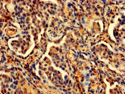 Polyclonal Rabbit anti-Human PDCD6 / ALG-2 Antibody (IHC, WB)