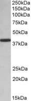 IHC-plus™ Polyclonal Goat anti-Human HnRNP-E1 / PCBP1 Antibody (aa234-247, IHC, WB)