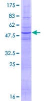 Human SLC6A11 / GAT-3 Protein (Recombinant GST)