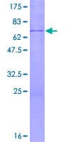 Human STK19 Protein (Recombinant GST)