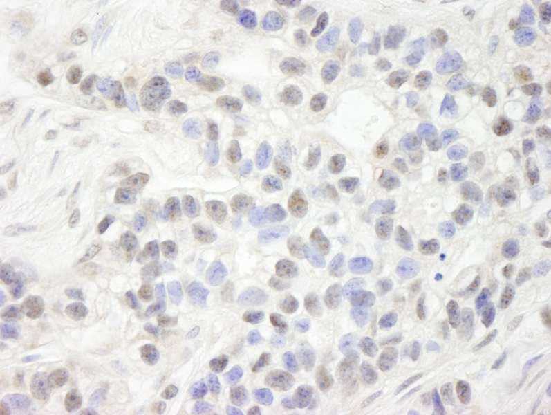 UHRF1 Antibody (aa275-325)