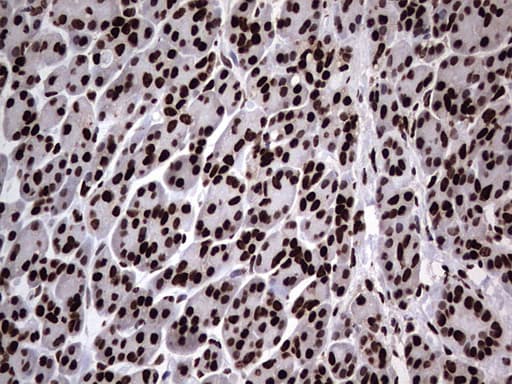 Monoclonal Mouse anti-Human HNRNPL / hnRNP L Antibody (clone OTI9G7, aa270-502, IHC, WB)