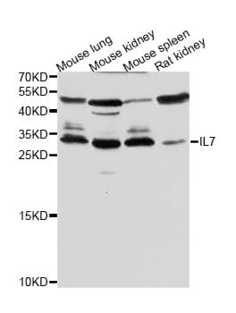 IHC-plus™ IL7 Antibody