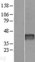 Human DRICH1 / C22orf43 Protein (Over-Expression Lysate Myc-DDK (Flag))