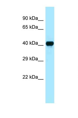 CKB / Creatine Kinase BB Antibody (aa284-333)