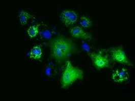 PANK2 Antibody (clone OTI4B3)