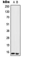 UTS2 / Urotensin II Antibody (Internal)