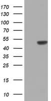 ZNF385B / ZNF533 Antibody (aa149-399, clone OTI2G4)