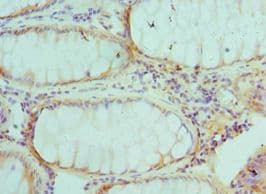 AKTIP / FTS Antibody (aa1-292)