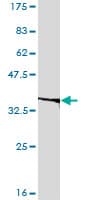 IHC-plus™ Monoclonal Mouse anti-Human EIF2B2 Antibody (clone 5B12-E10, IHC, WB)