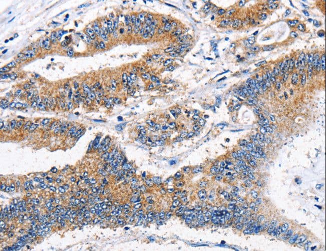 APLNR/ Apelin Receptor / APJ Antibody