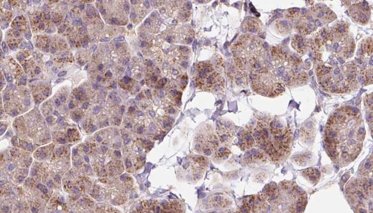 Polyclonal Rabbit anti-Human LGTN / EIF2D Antibody (IHC, IF, WB)
