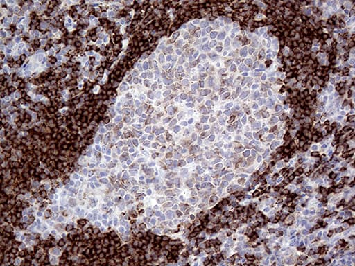 CD79B / CD79 Beta Antibody (clone OTI9G1, Carrier-free)