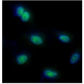 FUBP1 Antibody (clone AT14F5)