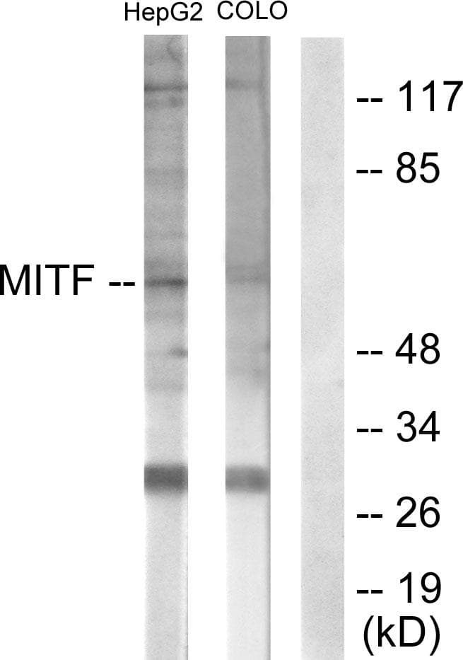 MITF Antibody (p180/73)