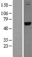 TRMU Protein (Over-Expression Lysate Myc-DDK (Flag))