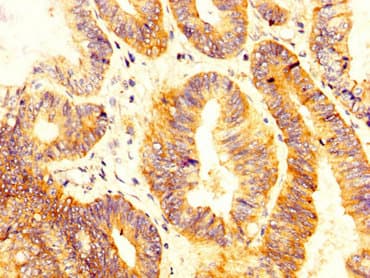 SLC12A2 / NKCC1 Antibody