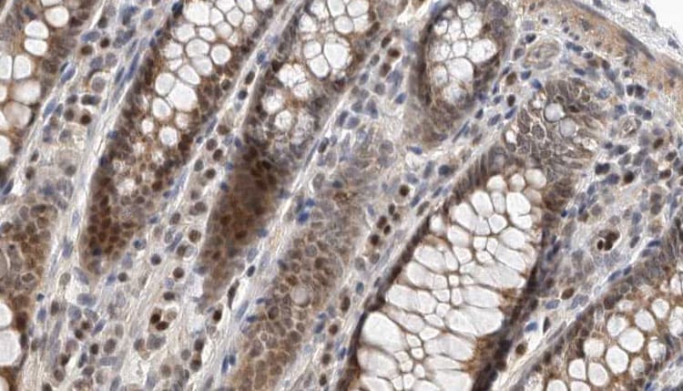 GIMAP5 Antibody